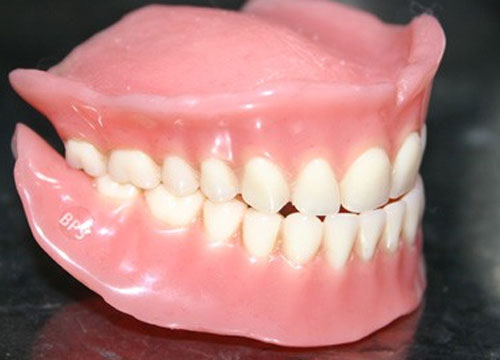 Dentures / False Teeth