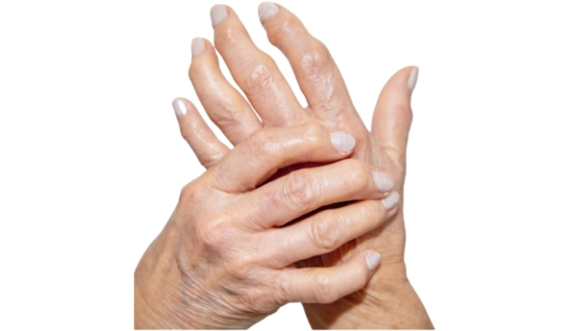 Rheumatology & Multiple Joint Pain